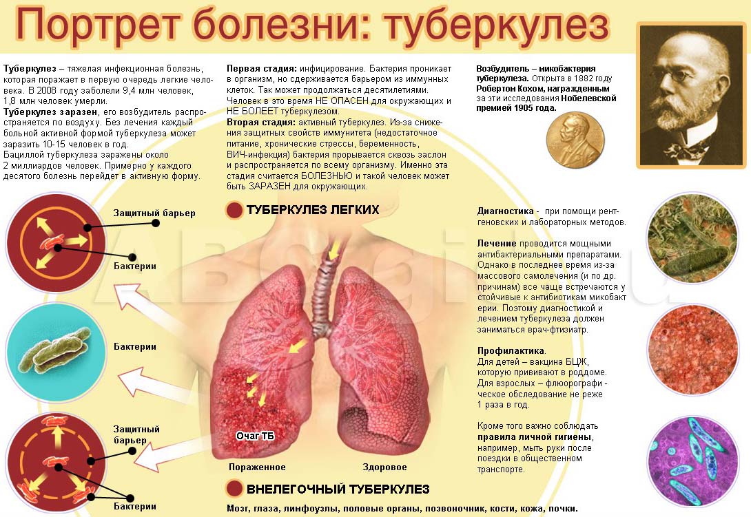 Всемирный день борьбы с туберкулезом